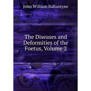   Deformities of the Foetus, Volume 2 John William Ballantyne Books