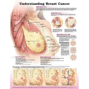  Understanding Breast Cancer Chart, 2nd Edition   Unmounted 