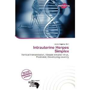  Intrauterine Herpes Simplex (9786200741912) Jerold 
