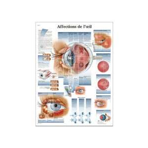   The Eye Anatomical Chart, French), Poster Size 20 Width x 26 Height