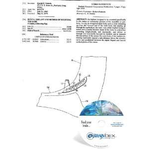  NEW Patent CD for DENTAL IMPLANT AND METHOD OF MOUNTING 