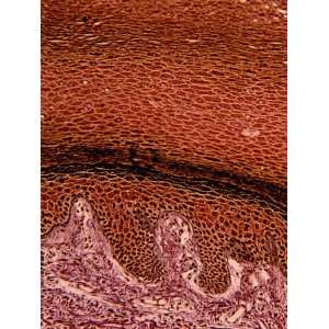 Human Thick Skin Cross Section with Dermal Papillae Beneath the 