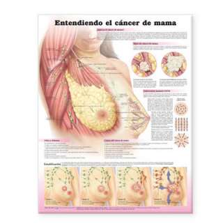 Understanding Breast Cancer Anatomical Chart in Spanish (Entendiendo 